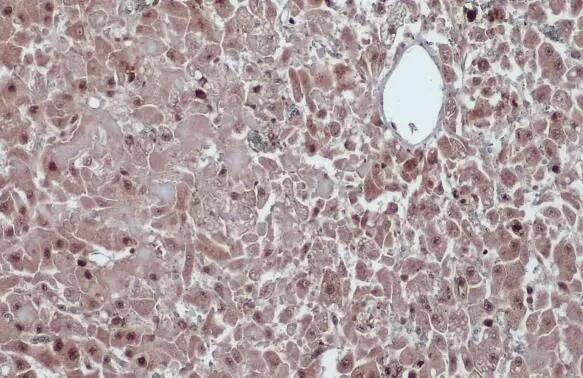 Cyclin D1 Antibody