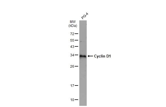 Cyclin D1 Antibody