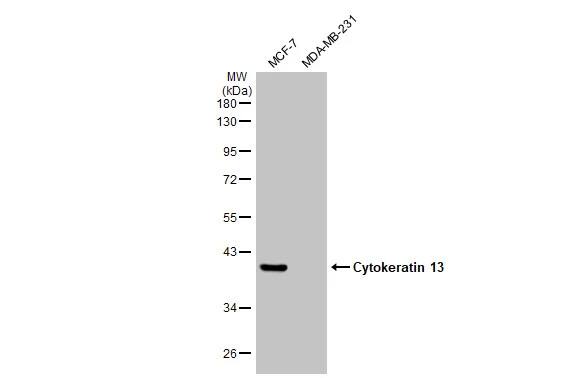 Cytokeratin 13 Antibody