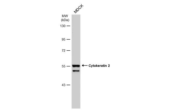 Cytokeratin 2 Antibody