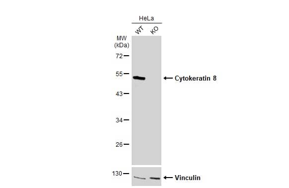 Cytokeratin 8 Antibody
