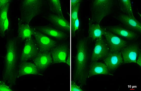 DDX3 Antibody