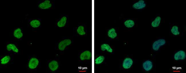 DNAJB6 Antibody - BSA Free