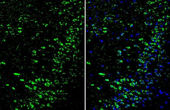 Dopamine D1R/DRD1 Antibody - BSA Free