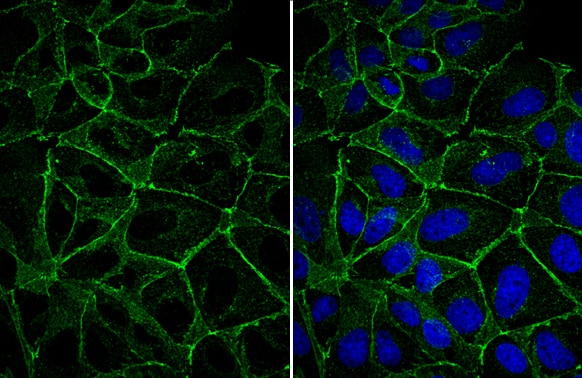 E-Cadherin Antibody