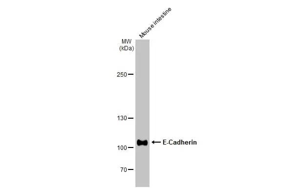 E-Cadherin Antibody