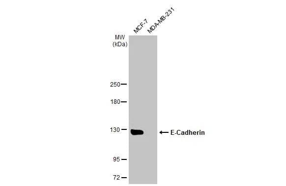 E-Cadherin Antibody