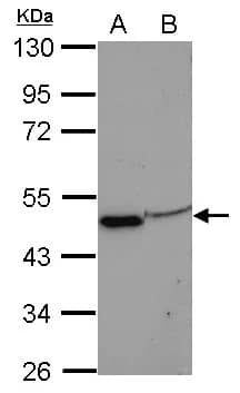 EIF3F Antibody