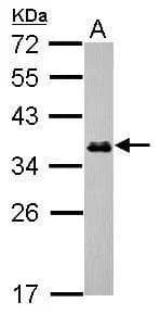 ESD Antibody