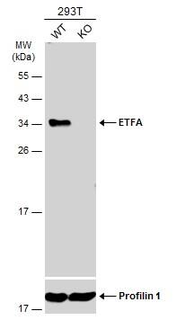 ETFA Antibody - BSA Free