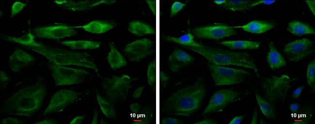 Fetuin Antibody - BSA Free