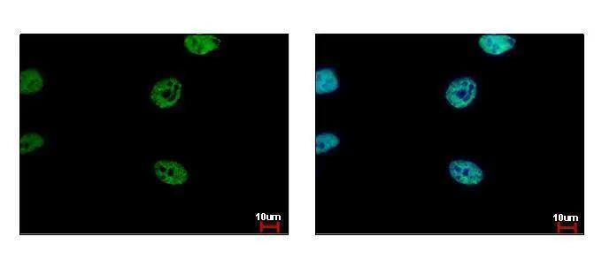 FLI1 Antibody - BSA Free