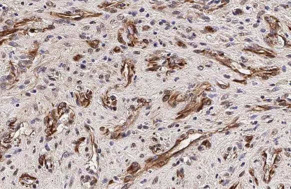 FOXO3 Antibody - BSA Free