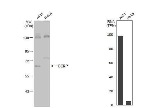 TRIM8 Antibody