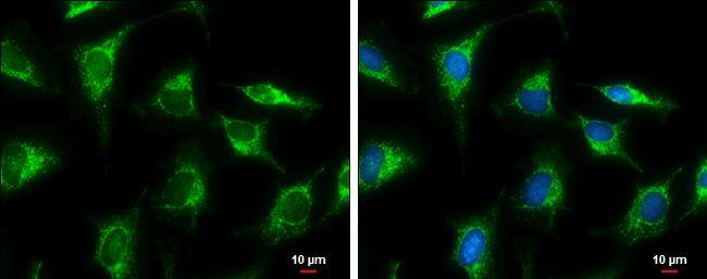 Glutamate Dehydrogenase 2/GLUD2 Antibody