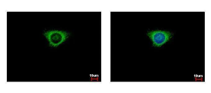 Glutathione S Transferase kappa 1 Antibody