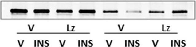 Glycogen phosphorylase, muscle form Antibody