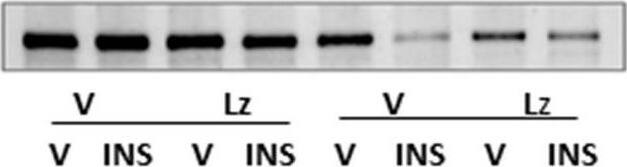 Glycogen phosphorylase, muscle form Antibody