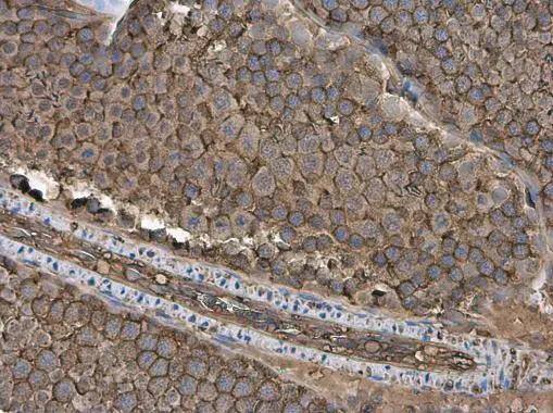 GNB1 Antibody - BSA Free