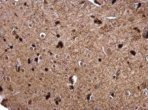 Glutathione S-Transferase pi 1/GSTP1 Antibody - BSA Free