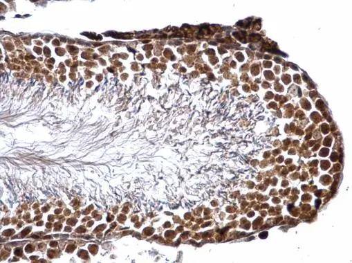 Glutathione S-Transferase pi 1/GSTP1 Antibody - BSA Free
