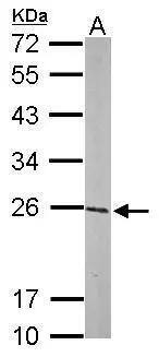 Glutathione S-Transferase pi 1/GSTP1 Antibody - BSA Free
