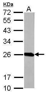 Glutathione S-Transferase pi 1/GSTP1 Antibody - BSA Free