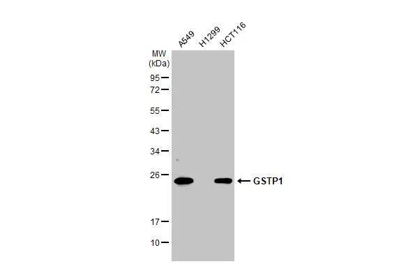Glutathione S-Transferase pi 1/GSTP1 Antibody - BSA Free