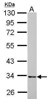 HADH Antibody