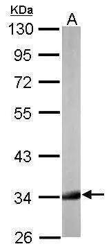 HADH Antibody - BSA Free