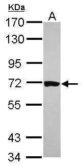 HCC1 Antibody