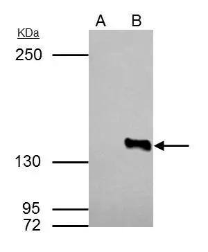 Histone Deacetylase 4/HDAC4 Antibody - BSA Free