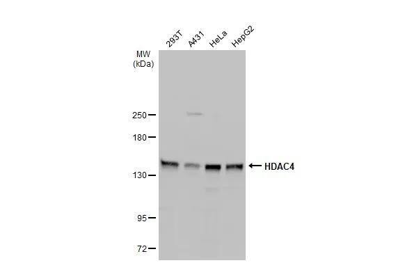 Histone Deacetylase 4/HDAC4 Antibody - BSA Free