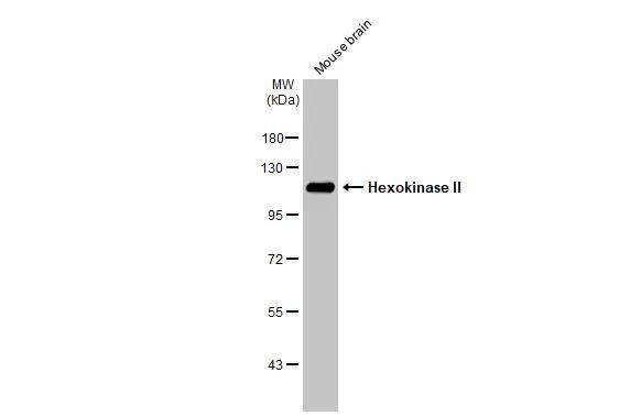 Hexokinase 2 Antibody - BSA Free