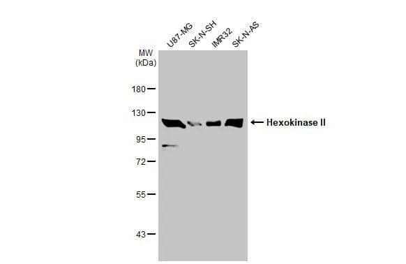Hexokinase 2 Antibody - BSA Free