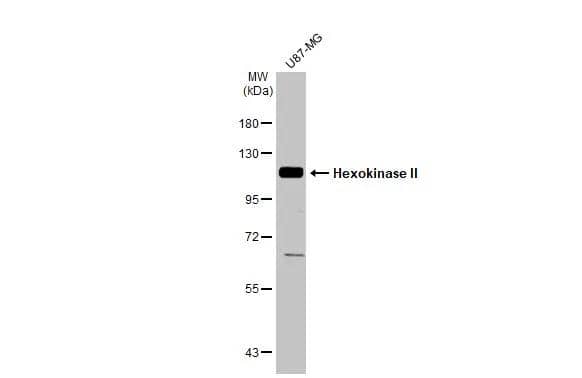 Hexokinase 2 Antibody - BSA Free