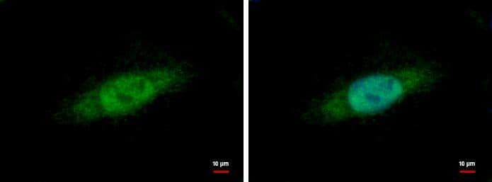 hHpr1-p84-Thoc1 Antibody