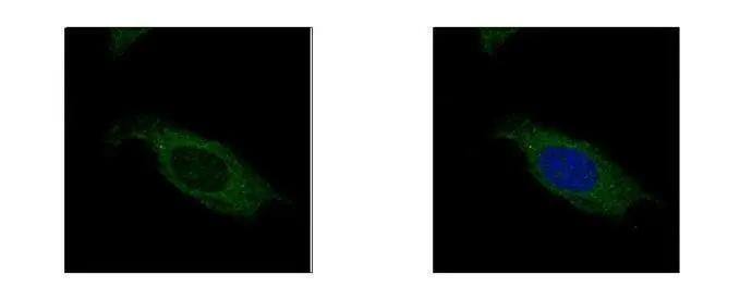HSD17B3 Antibody