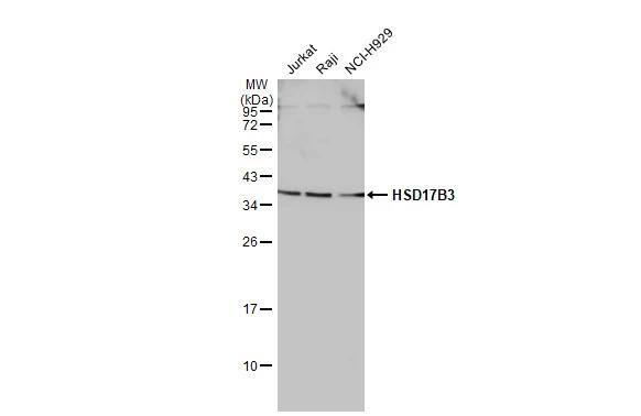 HSD17B3 Antibody