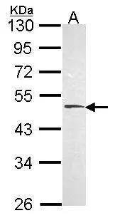 Hyaluronidase 1/HYAL1 Antibody - BSA Free
