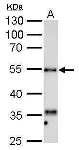 Hyaluronidase 1/HYAL1 Antibody - BSA Free