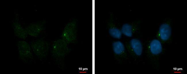 Ift80 Antibody - BSA Free