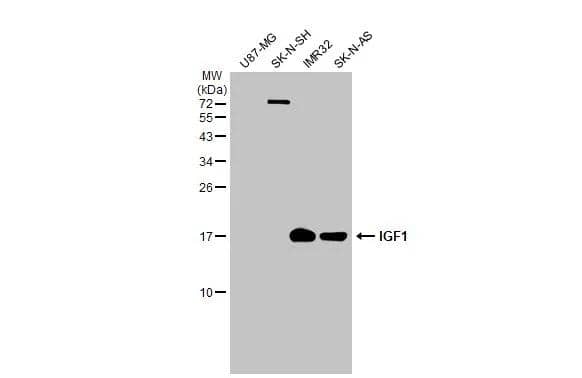 IGF-I/IGF-1 Antibody - BSA Free