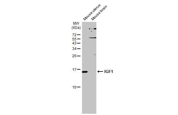 IGF-I/IGF-1 Antibody - BSA Free