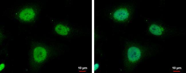 IGF2BP3 Antibody - BSA Free