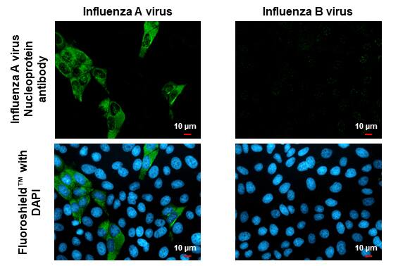Influenza A H1N1 Nucleoprotein Antibody - (A/WSN/1933)