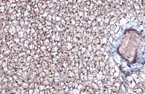Integrin beta 1/CD29 Antibody