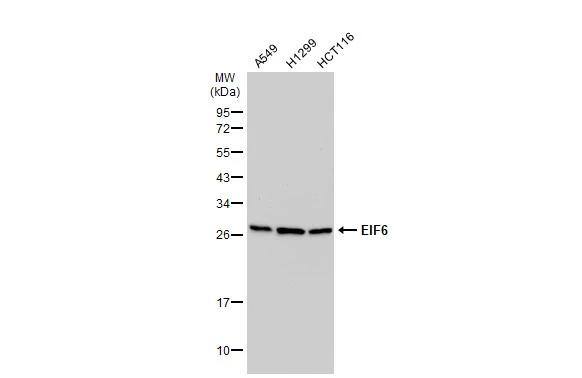 integrin beta 4 binding protein Antibody - BSA Free