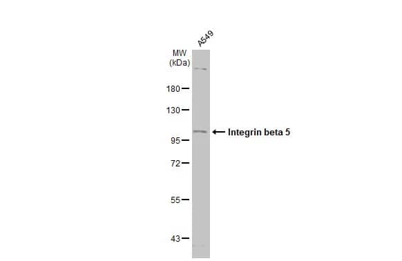 Integrin beta 5 Antibody