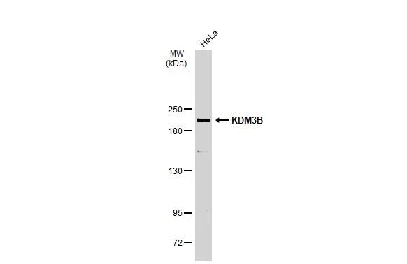 JMJD1B Antibody